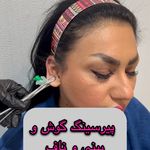 کلینیک لیزر و  زیبایی ملیح