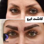 کلینیک زیبایی پوست و مو و لیزر پامچال