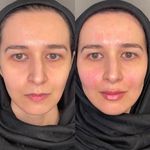 کلینیک پوست  و مو موتاکس