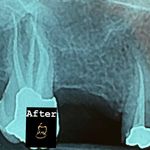 دکتر بیتا فتحی متخصص درمان ریشه