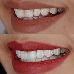 دندانپزشکی دکتر مهنوش محسنیان