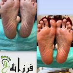 پدیکور و پدولوژیست فرزانه محمدی