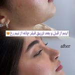 مرکز لیزر و کلینیک زیبایی پریفا