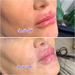 کلینیک زیبایی آفرینش،دکتر مهدی قهرمانیان