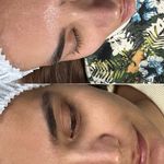 خدمات تخصصي پوست و تيرگي هاي بدن محبوبه