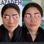 کلینیک زیبایی و لیزر دکتر آزاده اسماعیلی