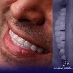 دندانپزشکی حامی (طرف قراردادبیمه نیستیم)