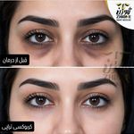 مرکز پی آر پی تهران