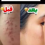 زیبایی بهداشت ومراقبت فردی پروین