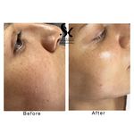 خدمات تخصصی فیشال سارا اسکین بار