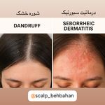موسسه آموزش و درمان انواع ریزش مو ریشه