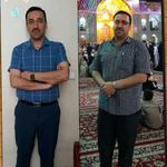 مشاور تغذیه و لاغری موضعی