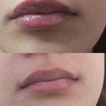 کلینیک زیبایی لاوین شرق