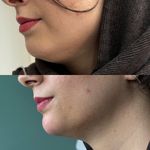 کلینیک زیبایی کهربا قرچک