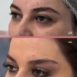 کلینیک زیبایی الماس کاملا اقساطی