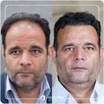 کلینیک پوست مو و زیبایی نوین ایرانا