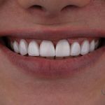 دندانپزشکی لایک دنتال