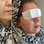 مرکز لیزرو کلینیک زیبایی طراوت