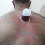 طب سنتی عامری (حجامت و بادکش)