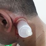 طب سنتی عامری (حجامت و بادکش)