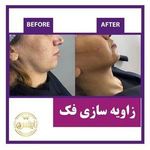 کلینیک لاغری آپیلنس