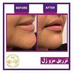 کلینیک لاغری آپیلنس