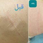 مرکز لیزرو کلینیک زیبایی طراوت