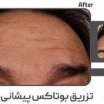کلینیک زیبایی و لیزر الکس کندلا پارادایس
