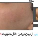 کلینیک زیبایی و لیزر الکس کندلا پارادایس