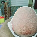 کاشت مو وابرو وی ای پی افروز