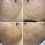 مرکز تخصصی فیشال و پوست حدیث