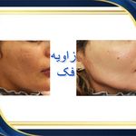 کلینیک پوست مو زیبایی هلیا