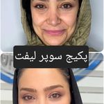 کلینیک پوست وزیبایی ومرکز تخصصی فیلربادی