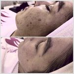 آموزش و خدمات فیشال و پاکسازی پوست aliva