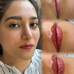مرکز تخصصی فیبرز ابر‌و حمیده رحیمی