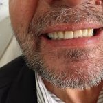 دندانسازی حسینی