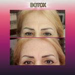 مطب پوست ،مو و لیزر یسنا طب