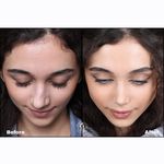 دکتر بهروز جلالی (جراحی بینی لیفت صورت)
