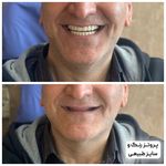 مجموعه دندان پزشکی و دندان سازی نچرال