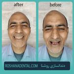 لابراتوار دندانسازی روشَنا