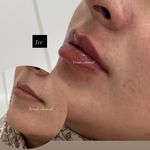 کلینیک پوست مو لیزر ونوس