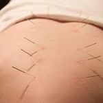 فیزیوتراپی دکتر اشرف واثق نیا