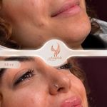 کلینیک زیبایی و مرکز لیزر هانیسا