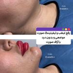 کلینیک تخصصی لاغری موضعی ولافیت