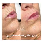 کلینیک زیبایی و لیزر مو زائد نوبا