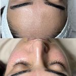 مرکز تخصصی فیشیال و مراقبت ازپوستsb,skin