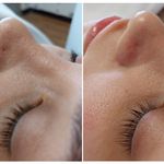 خدمات و آموزش  پاکسازی پوست در ساری