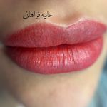 حانیه فراهانی،بنمژه،شیدینگ لب بدون دردقم