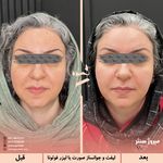 مرکز پزشکی و زیبایی میروژ سنتر