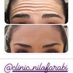 کلینیک پوست و مو و لیزر نیلوفر آبی